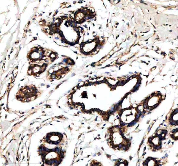 a14717 1 ralgapb primary antibodies ihc testing 2