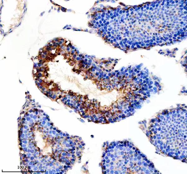 a14717 1 ralgapb primary antibodies ihc testing 3