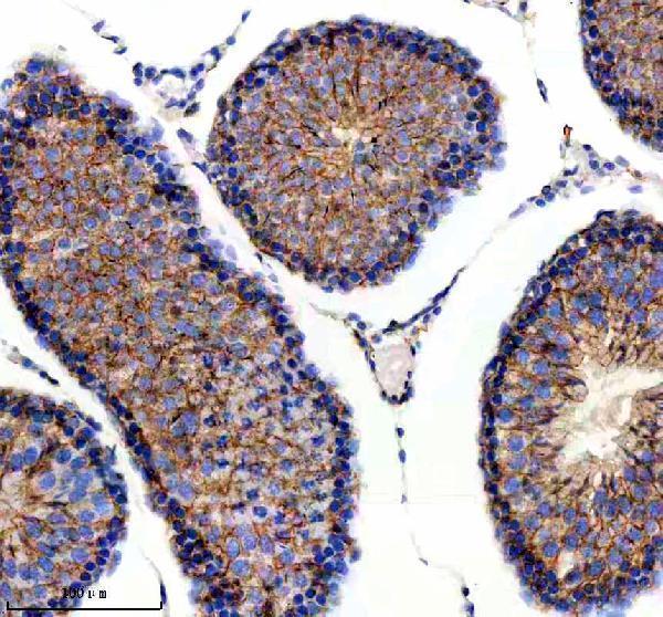 a14717 1 ralgapb primary antibodies ihc testing 4