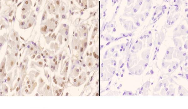 a14735 1 zscan22 primary antiboties ihc testing 2