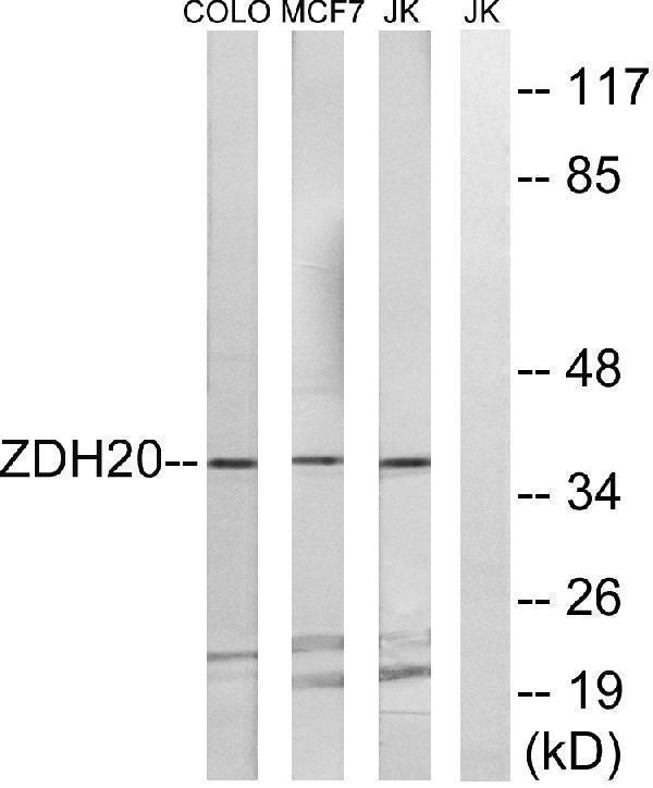 a14738 zdhhc20 primary antibodies wb testing 1