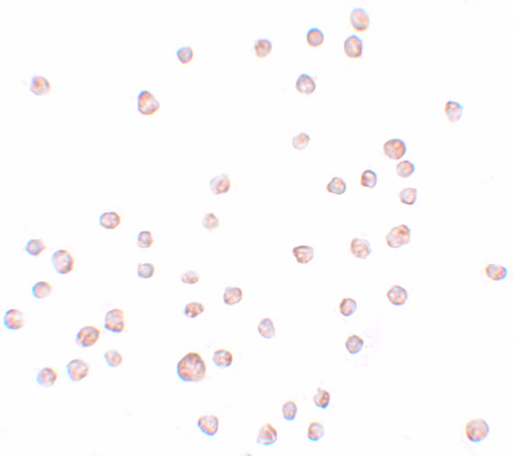 Immunocytochemistry of ENC-2 in Jurkat cells with ENC-2 antibody at 5 μg/mL