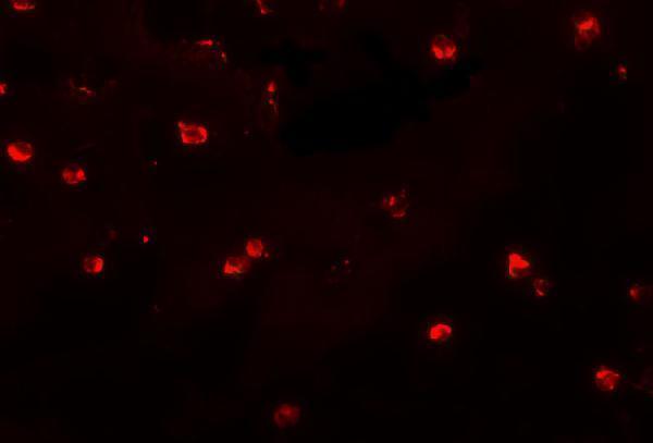 Immunofluorescence of ENC-2 in Jurkat cells with ENC-2 antibody at 20 μg/mL