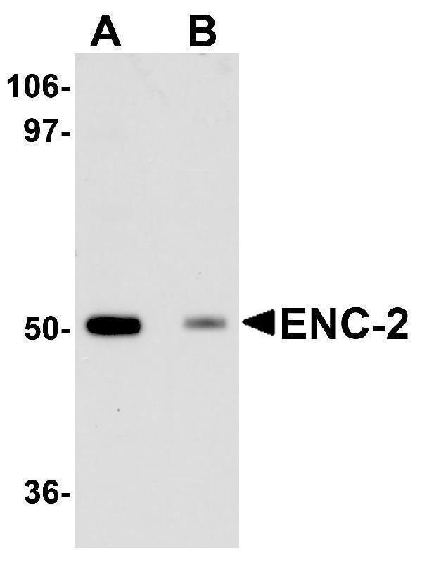 Western blot analysis of ENC-2 in Jurkat cell lysate with ENC-2 antibody at 1 μg/mL in (A) the absence and (B) the presence of blocking peptide