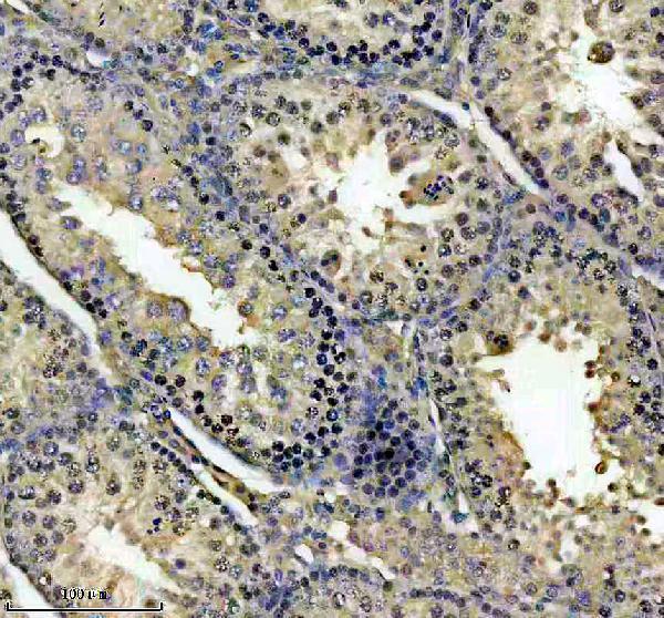 a14749 1 dhx40 primary antibodies ihc testing 1