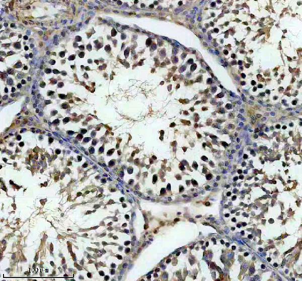 a14749 1 dhx40 primary antibodies ihc testing 2