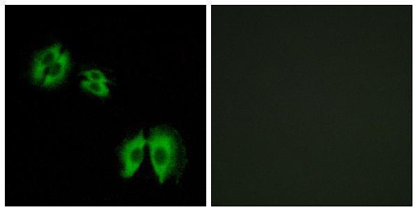a14751 b3galt2 primary antibodies if testing 1