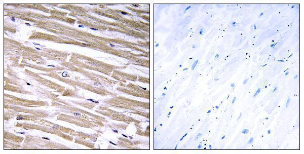 a14751 b3galt2 primary antibodies ihc testing 2