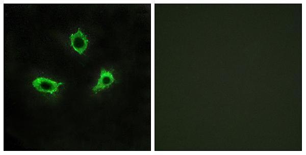 Immunofluorescence analysis of LOVO cells, using GPR115 Antibody
