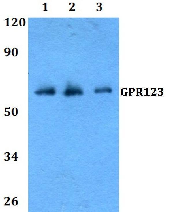 Western blot (WB) analysis of GPR123 polyclonal antibody at 1:500 dilution
Lane1:Hela whole cell lysate
Lane2:Raw264