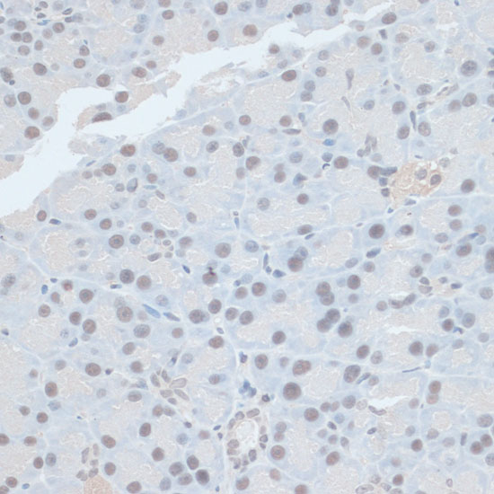 Immunohistochemistry of paraffin-embedded rat pancreas using ZNF581 antibody  at dilution of 1:100 