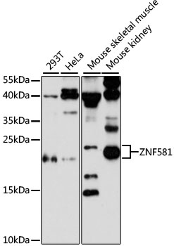 Western blot analysis of extracts of various cell lines, using ZNF581 antibody  at 1:3000 dilution