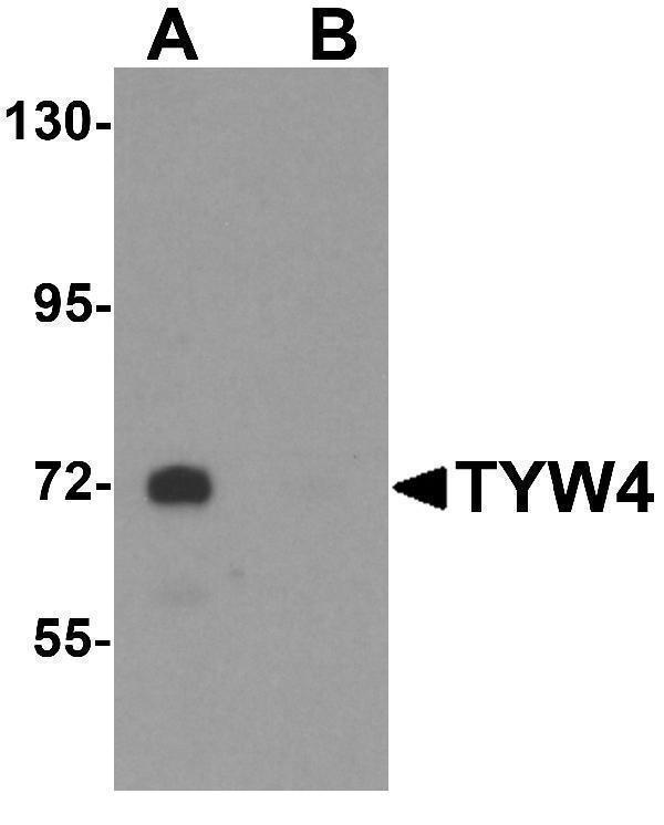 Western blot analysis of TYW4 in rat brain tissue lysate with TYW4 antibody at 1 μg/mL in (A) the absence and (B) the presence of blocking peptide