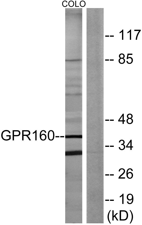 a14818 gpr160 primary antibodies wb testing 1