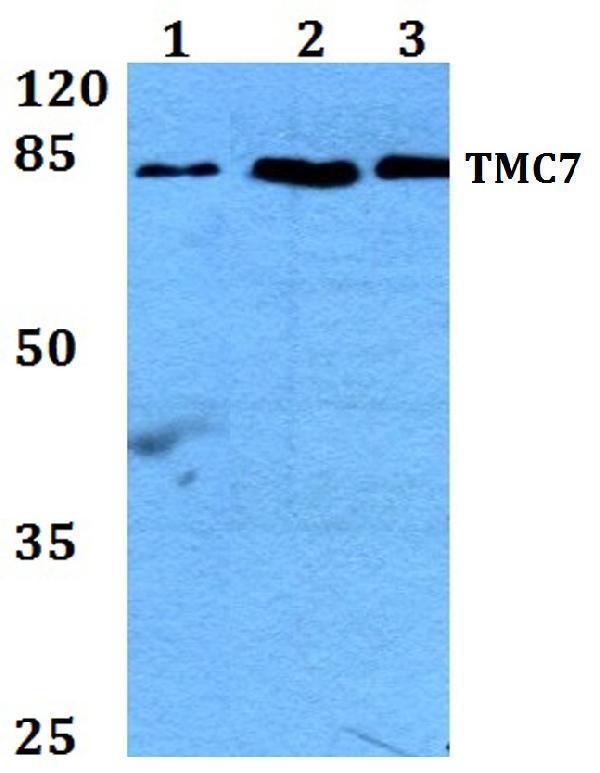 a14820 tmc7 primary antiboties wb testing 1