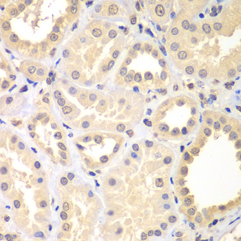 a14826 spin2b primary antiboties ihc testing 2