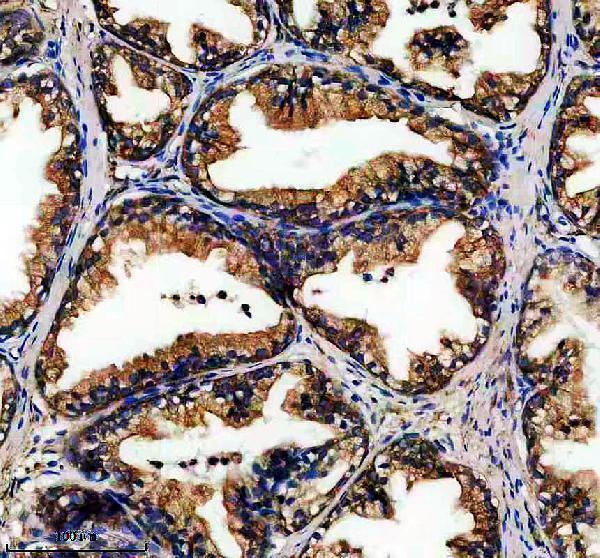 IHC analysis of ENDOD1 using anti-ENDOD1 antibody (A14829-1)