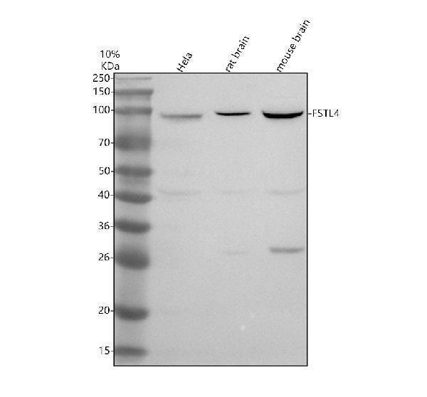 Western blot analysis of FSTL4 using anti-FSTL4 antibody (A14838-2)