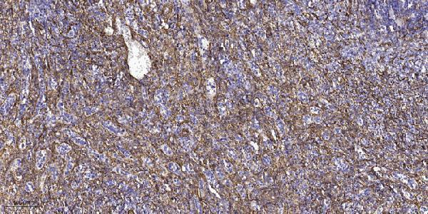 Immunohistochemical analysis of paraffin-embedded human spleen tissue