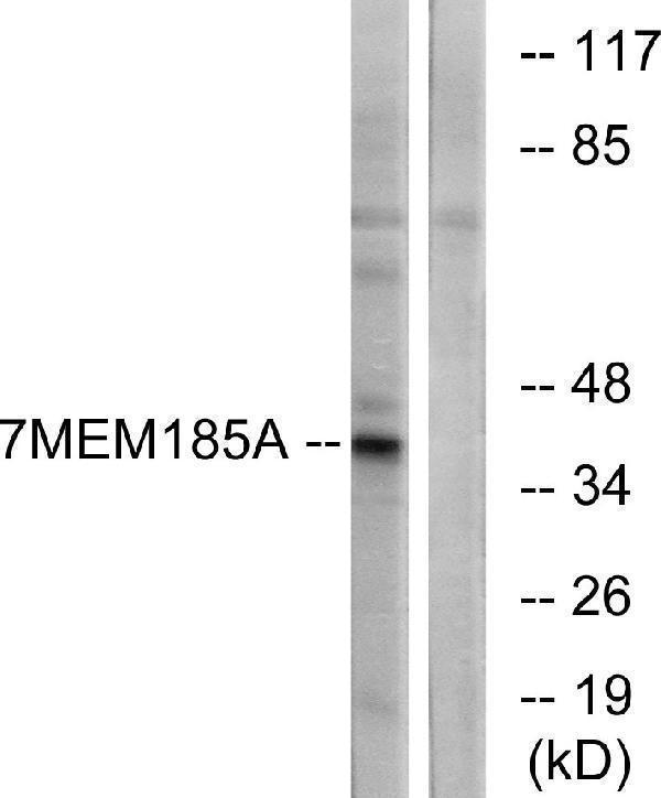 a14846 tmem185a primary antibodies wb testing 3