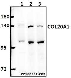 Western blot (WB) analysis of COL20A1 polyclonal antibody at 1:500 dilution
Lane1:A549 whole cell lysate(40ug)
Lane2:L02 whole cell lysate(40ug)
Lane3:HEK293T whole cell lysate(40ug)