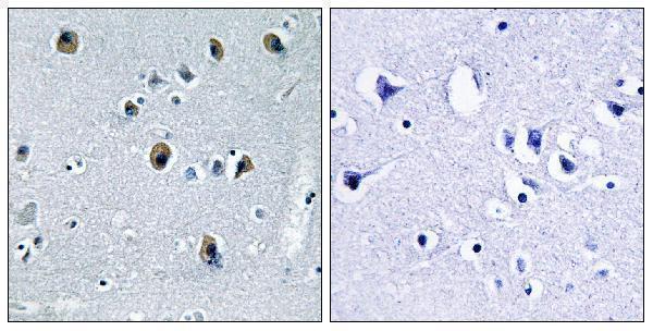 Immunohistochemistry analysis of paraffin-embedded human brain tissue, using Collagen XX alpha1 Antibody