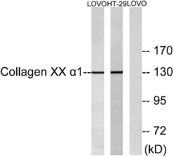Western blot analysis of lysates from LOVO and HT-19 cells, using Collagen XX alpha1 Antibody