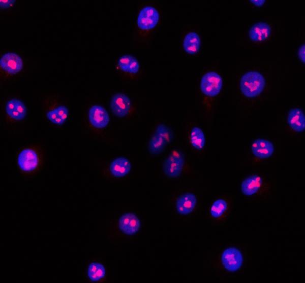 Figure 2. IF analysis of RSL24D1 using anti-RSL24D1 antibody (A14856-1). RSL24D1 was detected in an immunocytochemical section of A549 cells. Enzyme antigen retrieval was performed using IHC enzyme antigen retrieval reagent (AR0022) for 15 mins. The cells were blocked with 10% goat serum. And then incubated with 5 microg/mL rabbit anti-RSL24D1 Antibody (A14856-1) overnight at 4°C. Cy3 Conjugated Goat Anti-Rabbit IgG (BA1032) was used as secondary antibody at 1:500 dilution and incubated for 30 minutes at 37°C. The section was counterstained with DAPI. Visualize using a fluorescence microscope and filter sets appropriate for the label used.