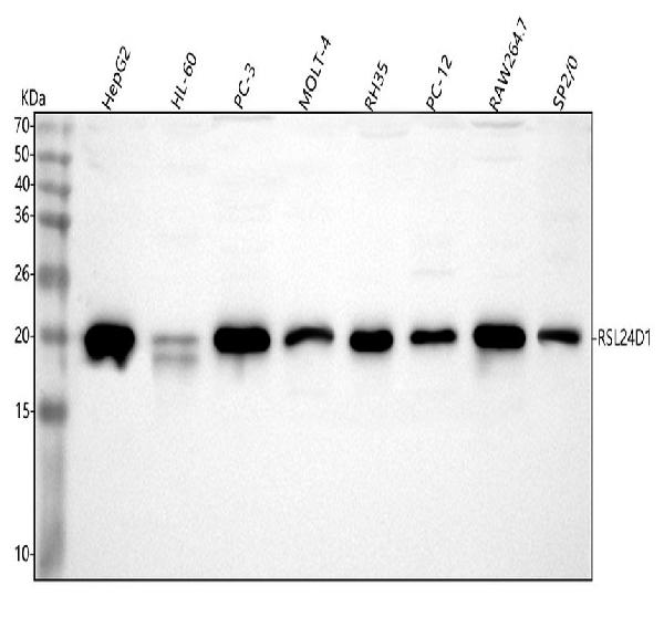 Figure 1. Western blot analysis of RSL24D1 using anti-RSL24D1 antibody (A14856-1). Electrophoresis was performed on a 5-20% SDS-PAGE gel at 70V (Stacking gel) / 90V (Resolving gel) for 2-3 hours. The sample well of each lane was loaded with 30 ug of sample under reducing conditions. Lane 1: human HepG2 whole cell lysates, Lane 2: human HL-60 whole cell lysates, Lane 3: human PC-3 whole cell lysates, Lane 4: human MOLT-4 whole cell lysates, Lane 5: rat RH35 whole cell lysates, Lane 6: rat PC-12 whole cell lysates, Lane 7: mouse RAW264.7 whole cell lysates, Lane 8: mouse SP2/0 whole cell lysates. After electrophoresis, proteins were transferred to a nitrocellulose membrane at 150 mA for 50-90 minutes. Blocked the membrane with 5% non-fat milk/TBS for 1.5 hour at RT. The membrane was incubated with rabbit anti-RSL24D1 antigen affinity purified polyclonal antibody (Catalog # A14856-1) at 0.25 microg/mL overnight at 4°C, then washed with TBS-0.1%Tween 3 times with 5 minutes each and probed with a goat anti-rabbit IgG-HRP secondary antibody at a dilution of 1:5000 for 1.5 hour at RT. The signal is developed using an Enhanced Chemiluminescent detection (ECL) kit (Catalog # EK1002) with Tanon 5200 system. A specific band was detected for RSL24D1 at approximately 20 kDa. The expected band size for RSL24D1 is at 20 kDa.