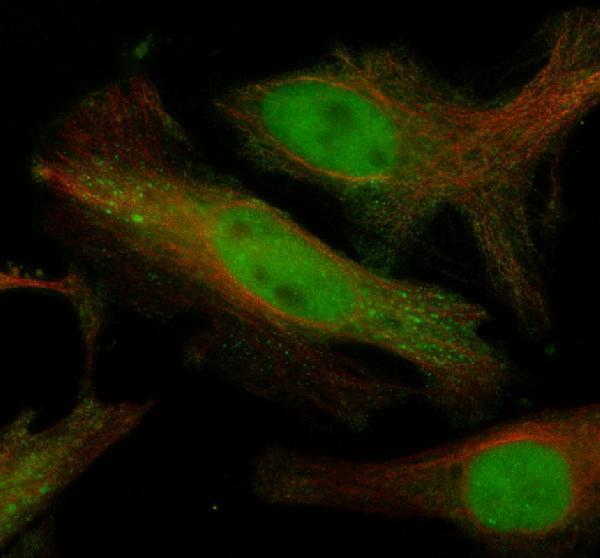 a14858 1 dhx37 primary antibodies if testing 1