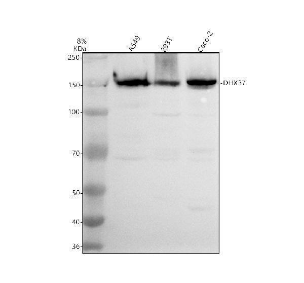 a14858 1 dhx37 primary antibodies wb testing 1