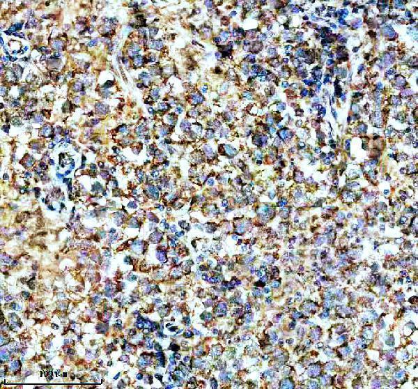 a14863 1 spata6 primary antibodies ihc testing 1