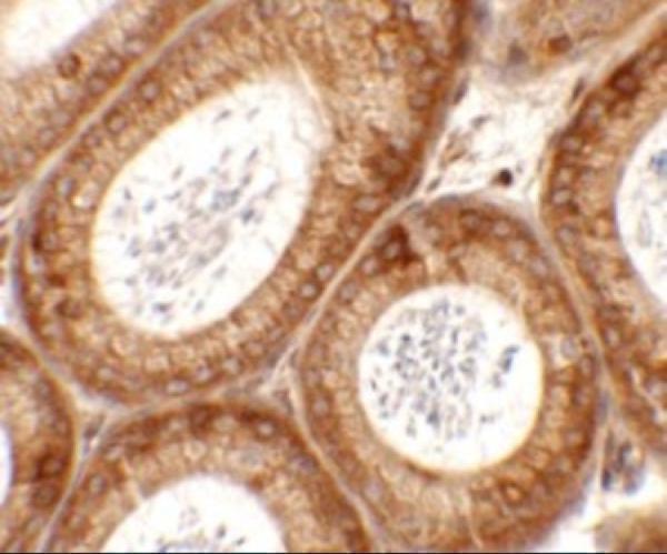 a14863 spata6 primary antibodies ihc testing 2