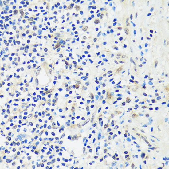 Immunohistochemistry of paraffin-embedded human appendix using ASCL4 antibody  at dilution of 1:100 