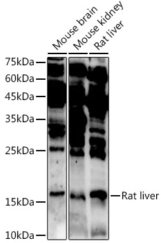 Western blot analysis of extracts of various cell lines, using ASCL4 antibody  at 1:1000 dilution