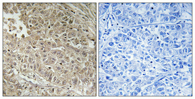 a14867 abcc13 primary antibodyes ihc testing 3