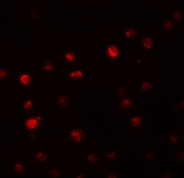 a14868 ppapdc2 primary antibodies if testing 2