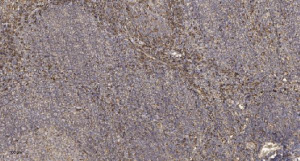 a14875 rgpd8 primary antibodies ihc testing 1