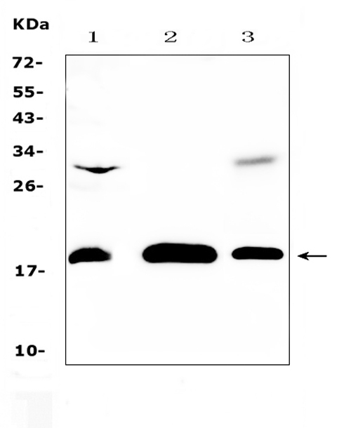 Western blot analysis of TMEM240 using anti-TMEM240 antibody (A14889). Electrophoresis was performed on a 5-20% SDS-PAGE gel at 70V (Stacking gel) / 90V (Resolving gel) for 2-3 hours. The sample well of each lane was loaded with 50ug of sample under reducing conditions. Lane 1: rat brain tissue lysates, Lane 2: NIH3T3 whole Cell lysates, Lane 3: COLO320 whole cell lysates. After Electrophoresis, proteins were transferred to a Nitrocellulose membrane at 150mA for 50-90 minutes. Blocked the membrane with 5% Non-fat Milk/ TBS for 1.5 hour at RT. The membrane was incubated with rabbit anti-TMEM240 antigen affinity purified polyclonal antibody (Catalog # A14889) at 0.5 μg/mL overnight at 4°C, then washed with TBS-0.1%Tween 3 times with 5 minutes each and probed with a goat anti-rabbit IgG-HRP secondary antibody at a dilution of 1:10000 for 1.5 hour at RT. The signal is developed using an Enhanced Chemiluminescent detection (ECL) kit (Catalog # EK1002) with Tanon 5200 system. A specific band was detected for TMEM240 at approximately 19KD. The expected band size for TMEM240 is at 19KD.
