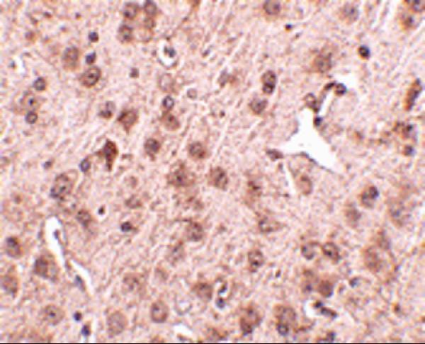 a14892 nipsnap3a primary antibodies ihc testing 2