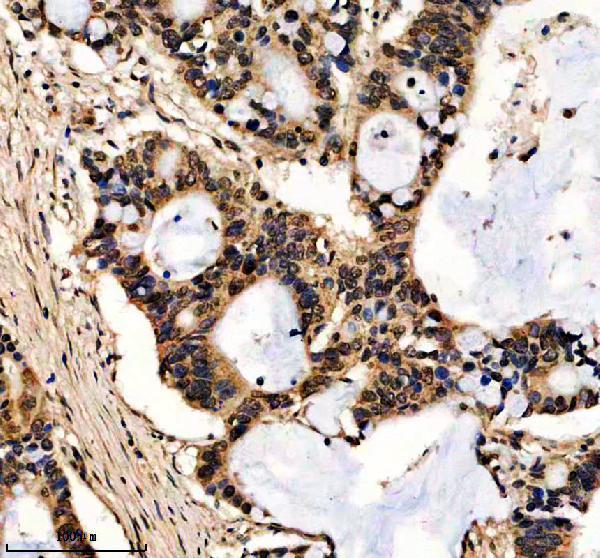 a14896 1 hspa7 primary antibodies ihc testing 1