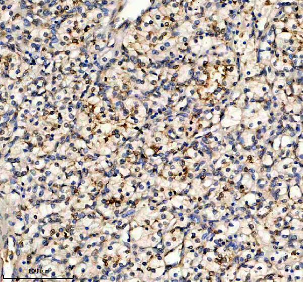 a14896 1 hspa7 primary antibodies ihc testing 2