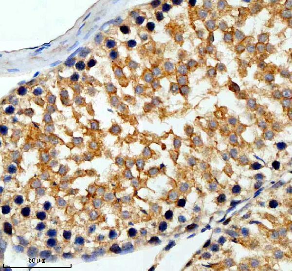 IHC analysis of SLC6A16 using anti-SLC6A16 antibody (A14901-2)