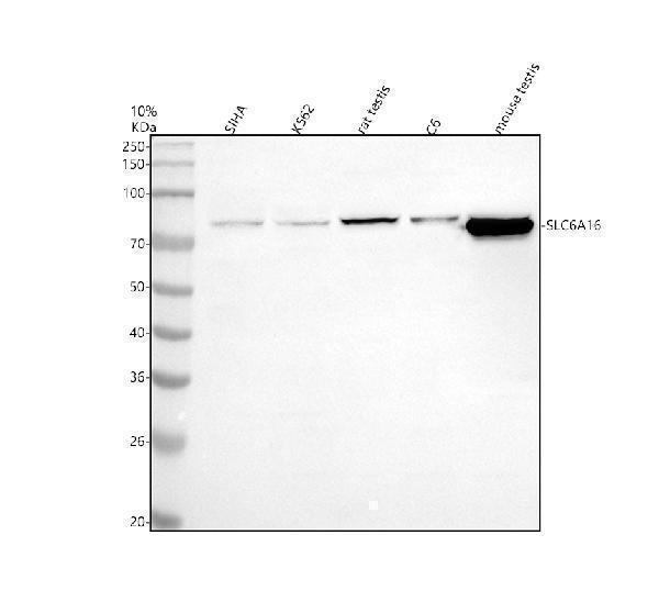 Western blot analysis of SLC6A16 using anti-SLC6A16 antibody (A14901-2)