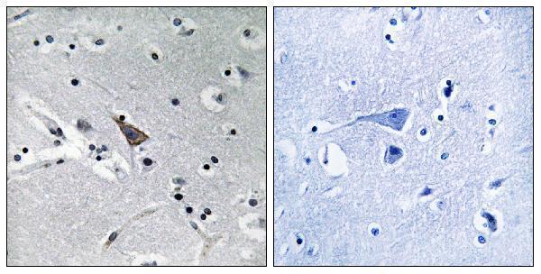 Immunohistochemistry analysis of paraffin-embedded human brain, using SLC6A16 Antibody