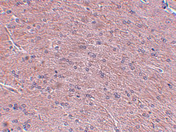 a14930 prosapip1 primary antibodies ihc testing 2