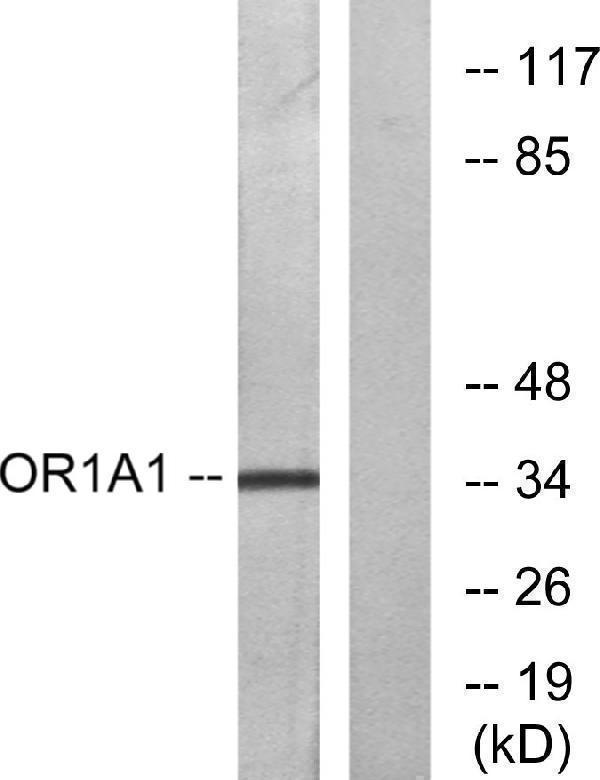 Western blot analysis of lysates from COLO cells, using OR1A1 Antibody