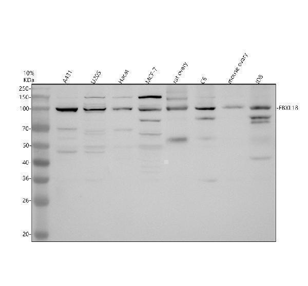 Western blot analysis of FBXL18 using anti-FBXL18 antibody (A14936-1)