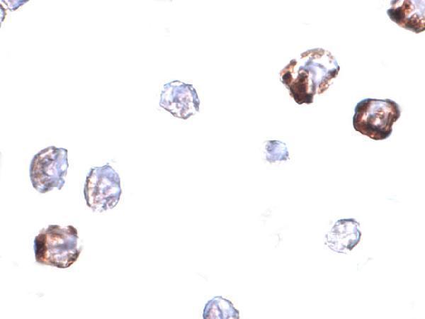 Immunocytochemistry of IRGC in A20 cells with IRGC antibody at 2