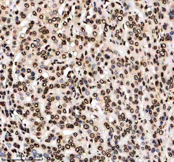 a14943 1 h2aj primary antibodies ihc testing 1